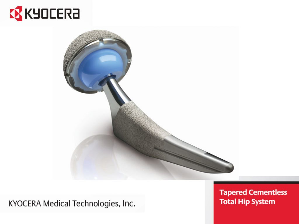 Total Hip Replacement (Ceramic on Ceramic) - Sarasota, FL: Schofield, Hand  and Bright Orthopaedics